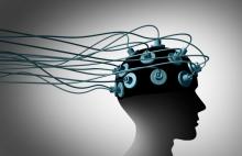 Eléctrodos implantados nunha cabeza.